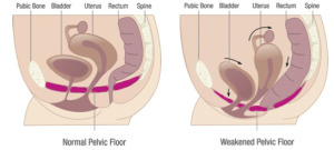 Pregnancy and the Pelvic Floor