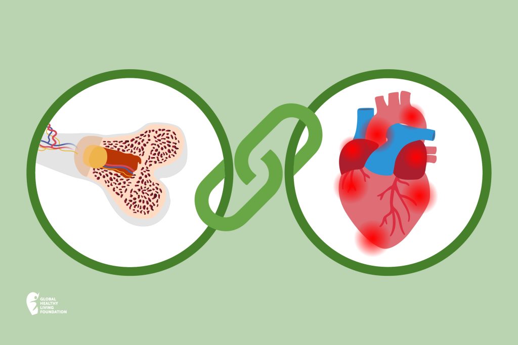 Osteoporosis and Cardiovascular Health